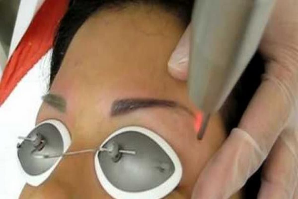 تعلم كيفية ازالة تاتو الحواجب خطوة بخطوة 1 ازالة تاتو الحواجب
