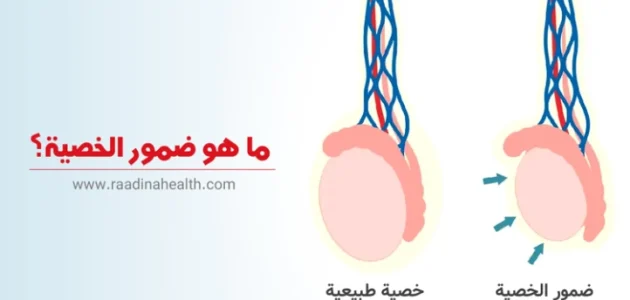 تجربتي مع ضمور الخصية وطرق العلاج 1 تجربتي مع ضمور الخصية