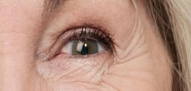 كيفية التخلص من تجاعيد العين بخطوات سهلة وبسيطة 1 كيفية التخلص من تجاعيد العين