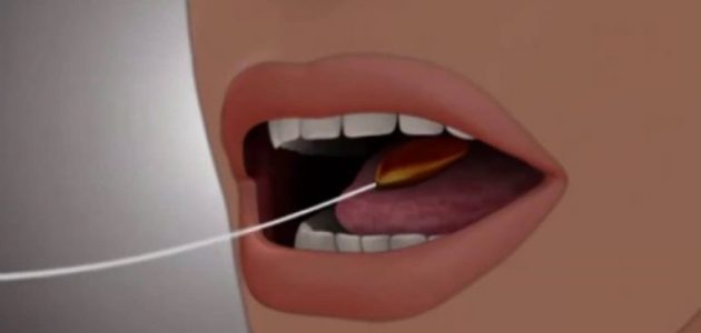 مين جربت بالون المعدة ونحفت وهل له أضرار؟ وأفضل تجربة صديقتي مع عملية بالون المعدة 1 مين جربت بالون المعدة ونحفت